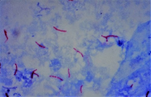 Acid Fast Staining - Ziehl Neelsen Method, Introduction, Reagent ...